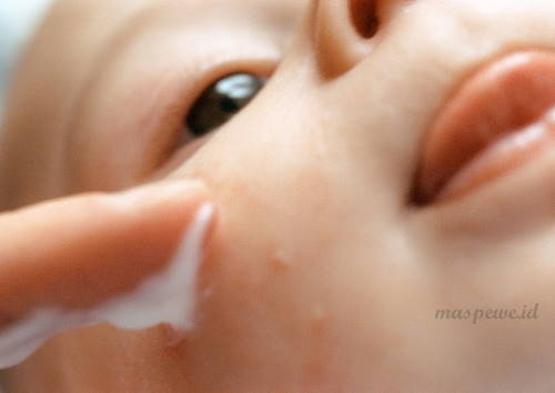 alergi pada bayi
